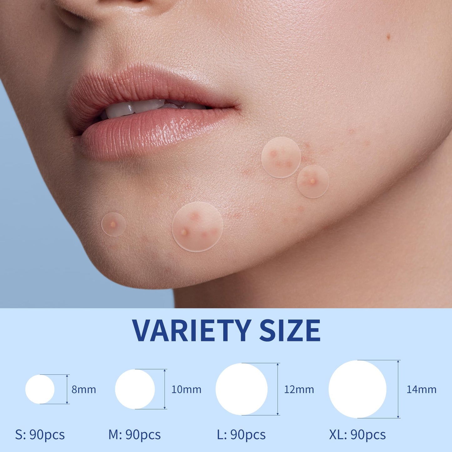 Pimple Patches for Face, 4 Size 300 Counts Acne Patches, Hydrocolloid Patches for Covering Zits and Blemishes, Spot Stickers with Salicylic Acid, Tea Tree Oil & Calendula Oil