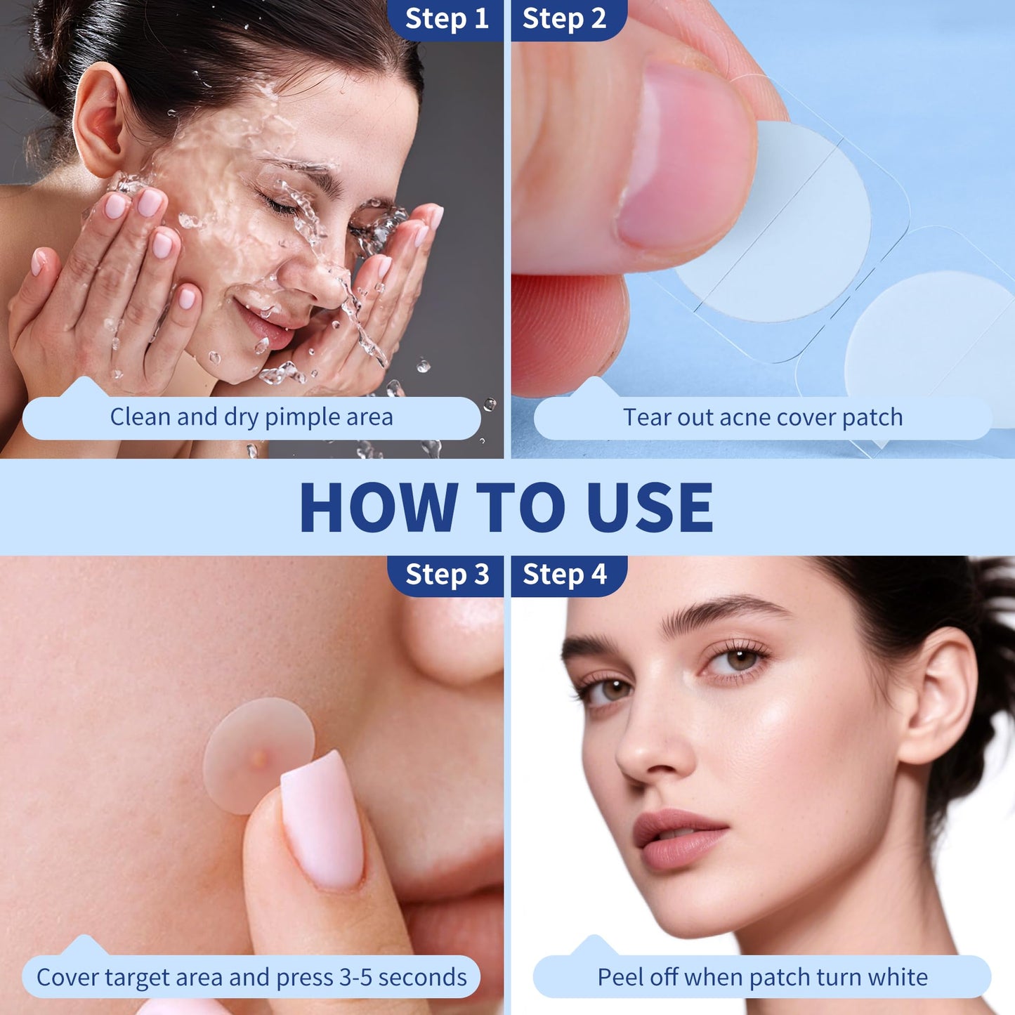 Pimple Patches for Face, 4 Size 300 Counts Acne Patches, Hydrocolloid Patches for Covering Zits and Blemishes, Spot Stickers with Salicylic Acid, Tea Tree Oil & Calendula Oil