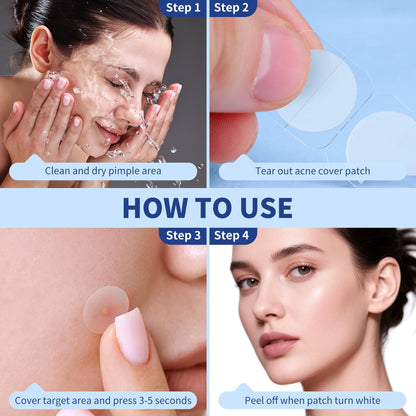 Pimple Patches for Face, 4 Size 300 Counts Acne Patches, Hydrocolloid Patches for Covering Zits and Blemishes, Spot Stickers with Salicylic Acid, Tea Tree Oil & Calendula Oil