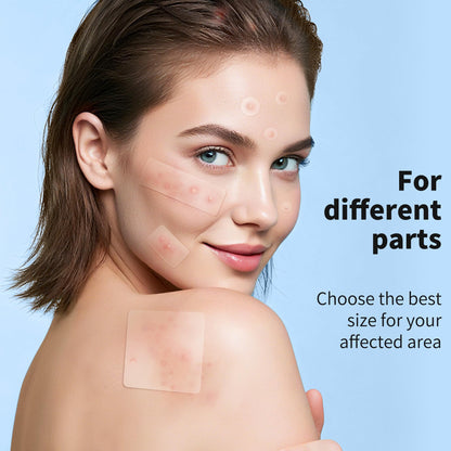 Pimple Patches for Face, 4 Size 300 Counts Acne Patches, Hydrocolloid Patches for Covering Zits and Blemishes, Spot Stickers with Salicylic Acid, Tea Tree Oil & Calendula Oil